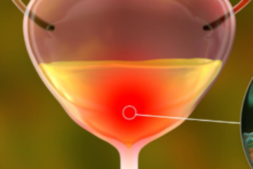 Urine Infection in Hindi