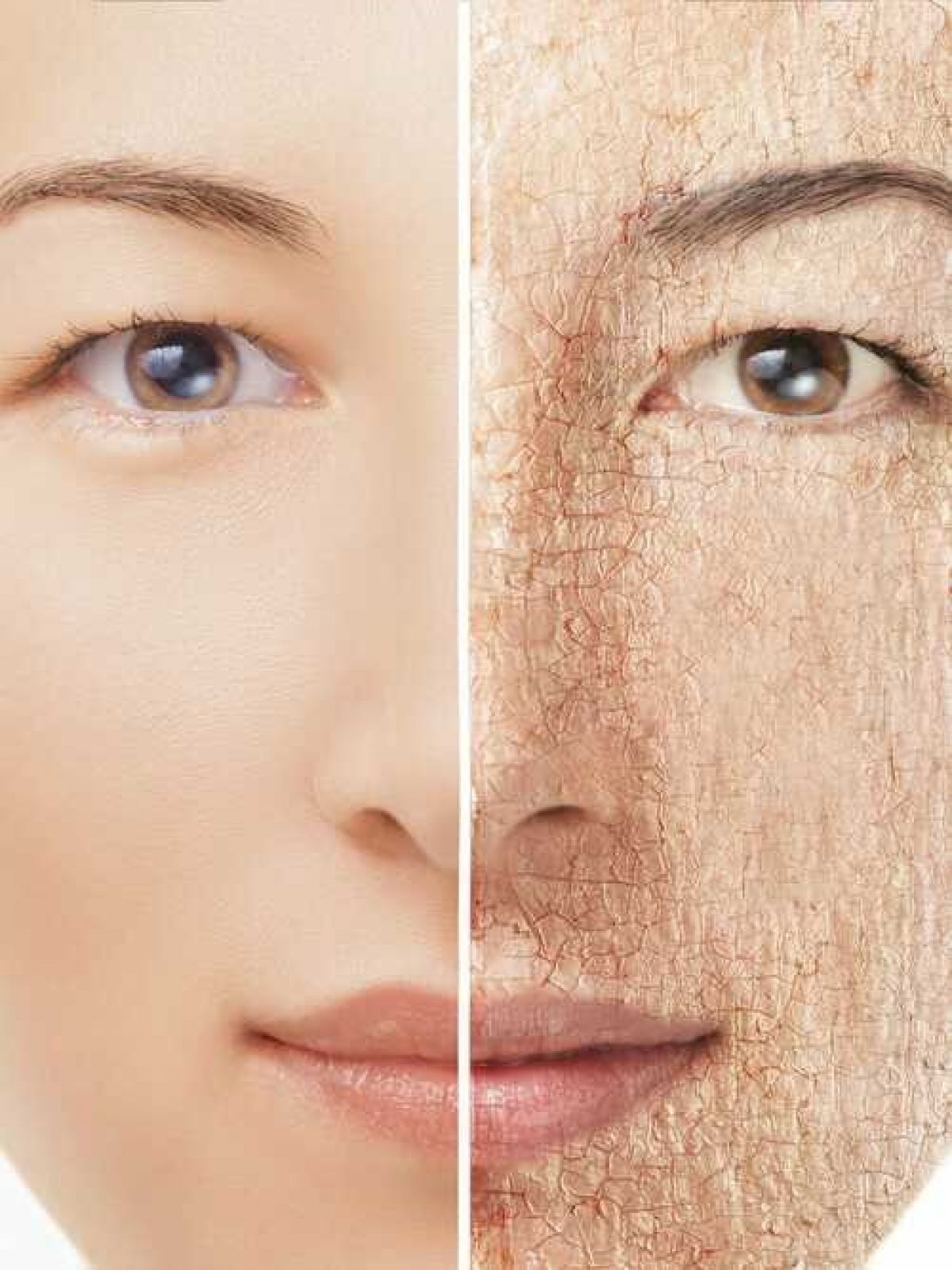 dry skin