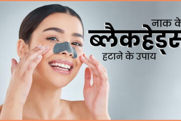 5 home remedies to remove blackheads