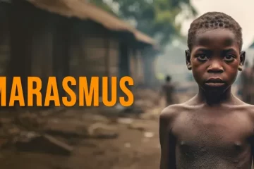Marasmus