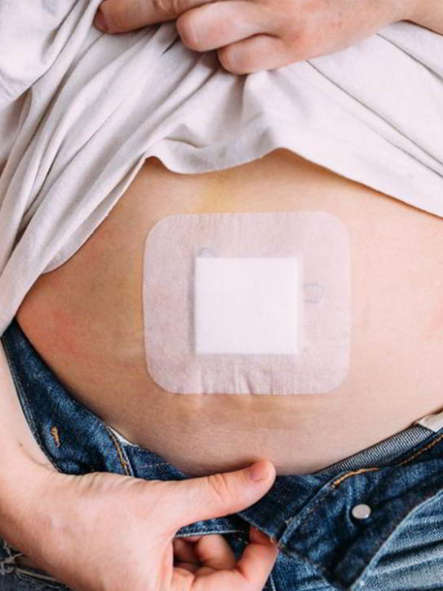 हर्निया के लक्षण – Symptoms of Hernia in Hindi