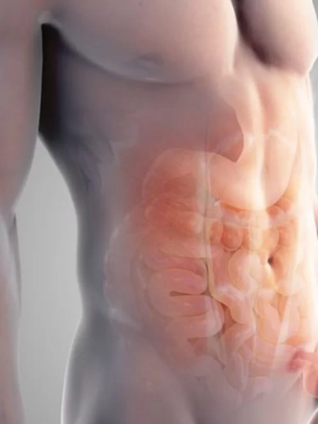 हर्निया के कारण – Causes of Hernia in Hindi