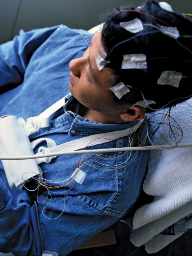 10 Ways to treat Epilepsy